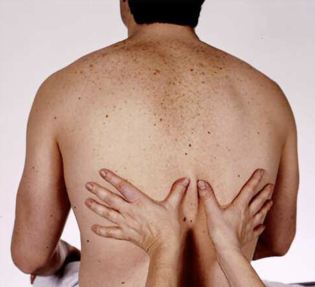 <ul><li><p>Place both hands on posterior chest with thumbs at T9 or T10</p></li><li><p>Pinch up a small fold of skin </p></li><li><p>Ask person to take a deep breath </p></li><li><p>Thumbs should move apart symmetrically </p></li><li><p>HOT TIP: T7 is in line with the inferior tip of scapula </p></li><li><p>Normal finding: symmetrical expansion of the chest </p></li></ul><p></p>
