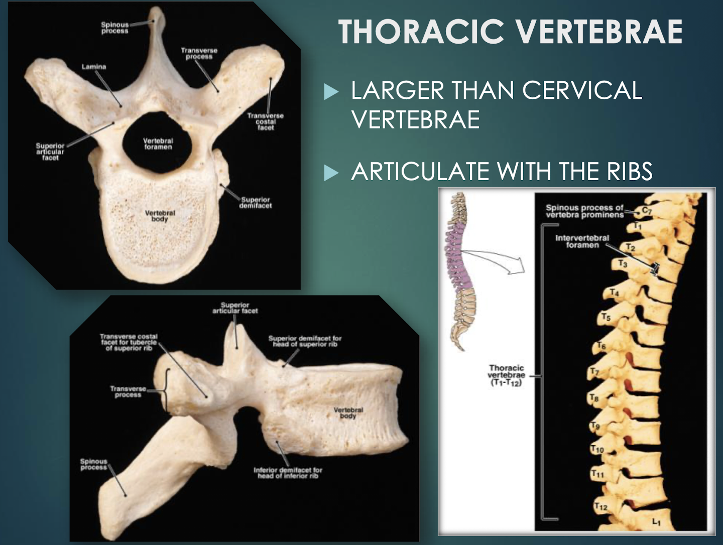 <p>Thoracic Vertebrae</p>