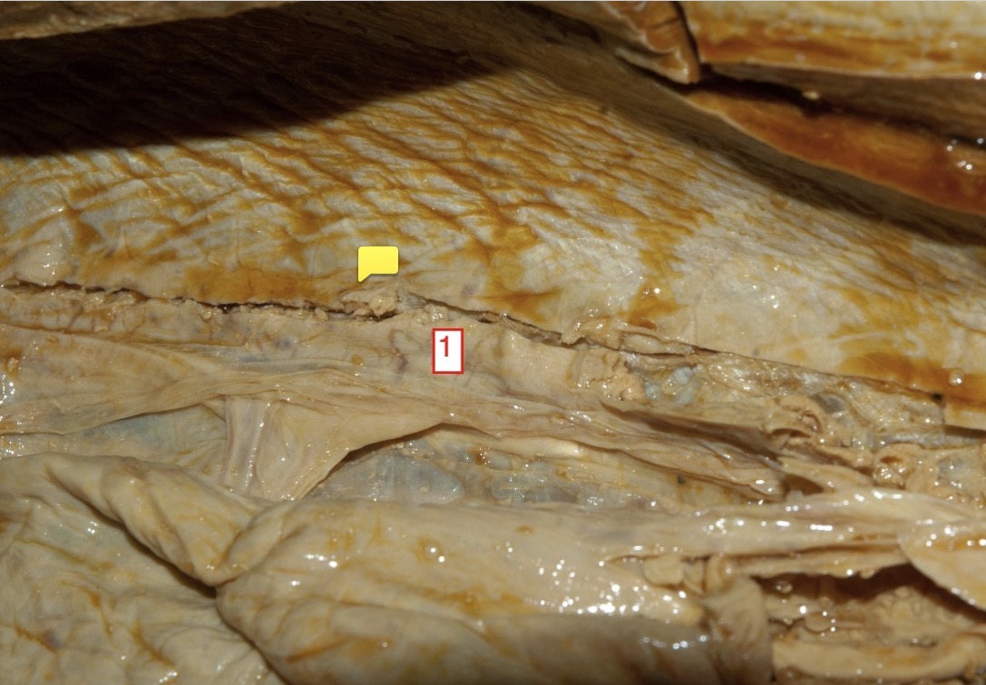 <p>female spiny dogfish- (1)</p>