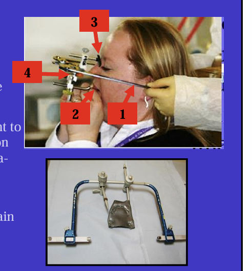 <p>What are the labelled features of the facebows? - all facebows have some features in common:</p>