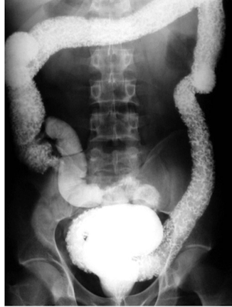 <p>What is this </p>