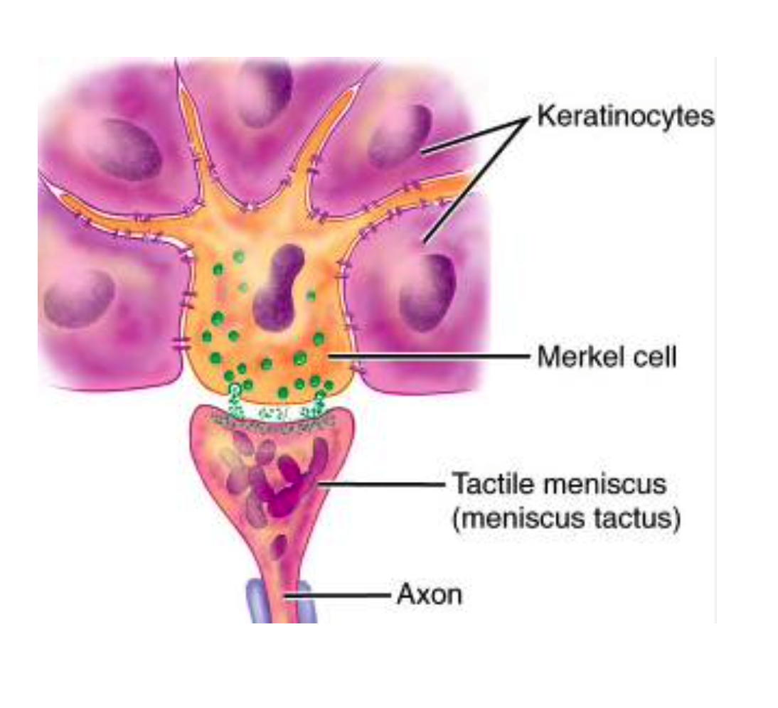 <p>Merkel cell</p><p><span>They are dendritic cells located in the stratum basale. They are most abundant in skin where sensory perception is acute, such as the fingertips. Merkel cells are bound to adjoining keratinocytes by desmosomes and contain intermediate (keratin) filaments in their cytoplasm.<br>Merkel cells are best characterized by the presence of dense-cored neurosecretory granules that resemble those found in the adrenal medulla.<br></span>Merkel<span> cells are closely associated with the expanded terminal bulb of afferent myelinated nerve fibers. The neuron terminal loses its Schwann cell covering and immediately penetrates the basal lamina, where it expands into a plate-like ending called a <em>disc receptor </em>that lies in close apposition to the base of the </span>Merkel <span>cell. The combination of the neuron and epidermal cell, called a </span>Merkel<span> corpuscle, is a sensitive mechanoreceptor.</span></p>