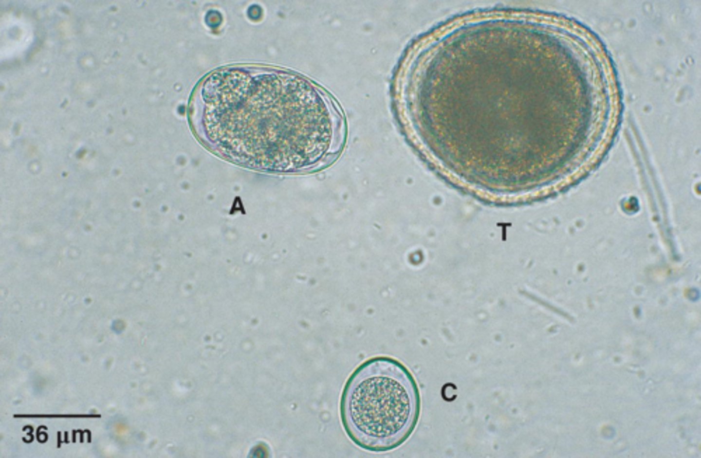 <p>What parasite is T if it is from a dog</p>