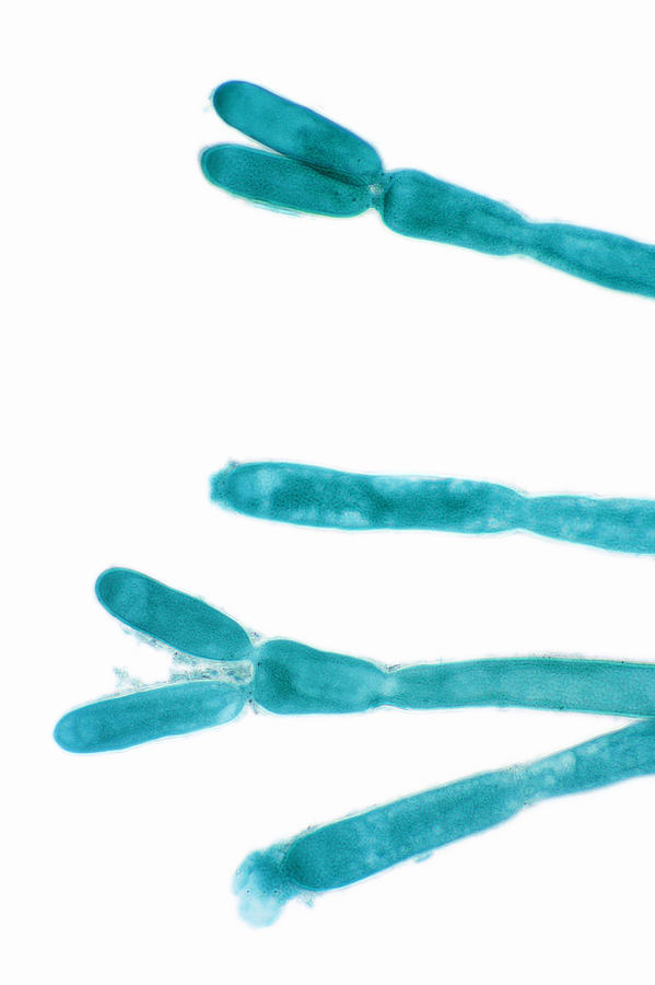 <p>Blue didos </p>
