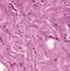 <p>Breast</p>
