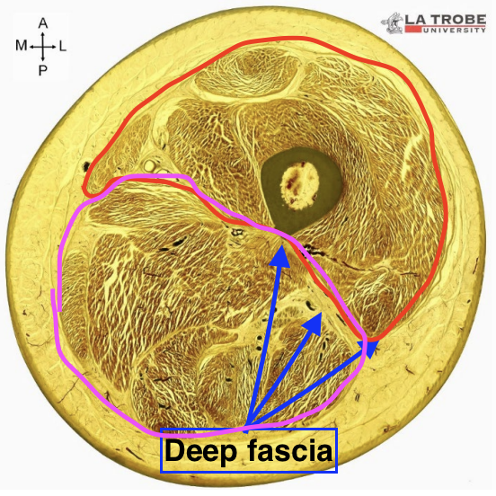 <p><strong><u>Dense irregular connective tissue.</u></strong></p><ul><li><p>enables the fascia to change shape without tearing as muscles grow/shrink with age</p></li><li><p>contains elastin fibres to help it recoil as the muscle relaxes</p></li></ul><p></p><p>Wraps tightly around muscles</p><p>Dividing muscle and connecting to adjacent bones</p><p>Compartmentalises muscles in limbs</p>