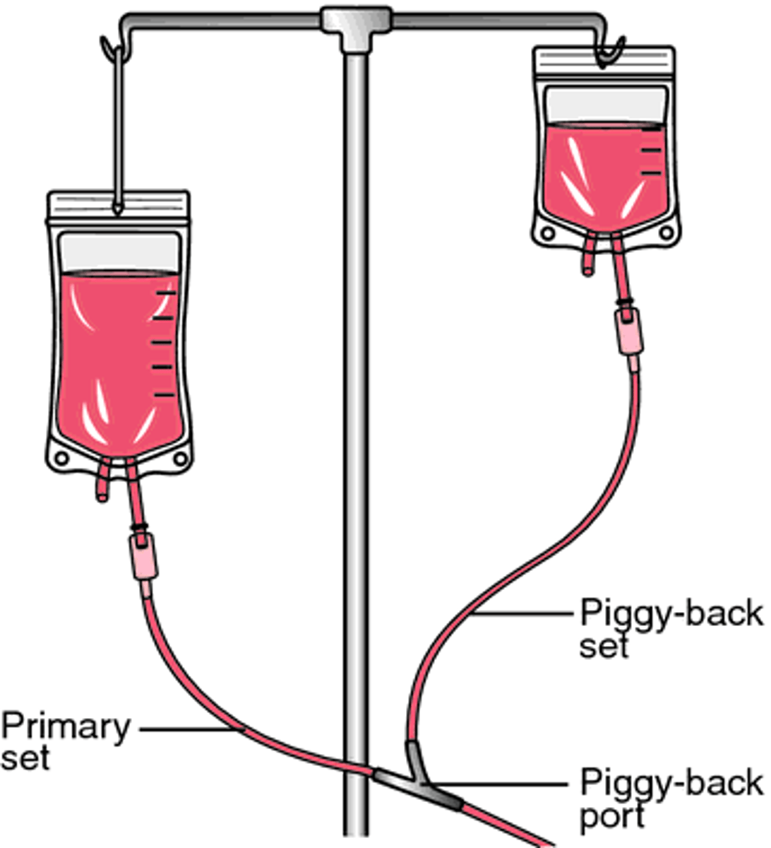 <p>intravenous piggyback; medication prepared in a small volume of fluid is attached to an IV (which is already infusing fluid into a patient's vein) at specified times</p>