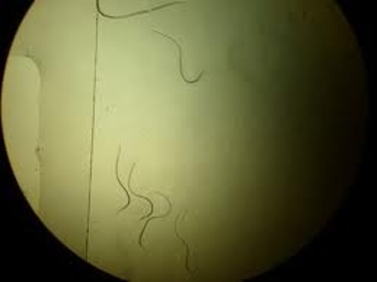 <p>Phylum Nematoda</p>