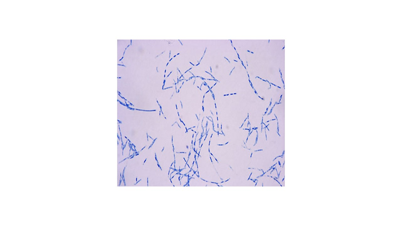 <p>l<span>ooking at the micrograph, does the bacteria Bacillus cereus produce the waxy material in its cell wall</span></p>