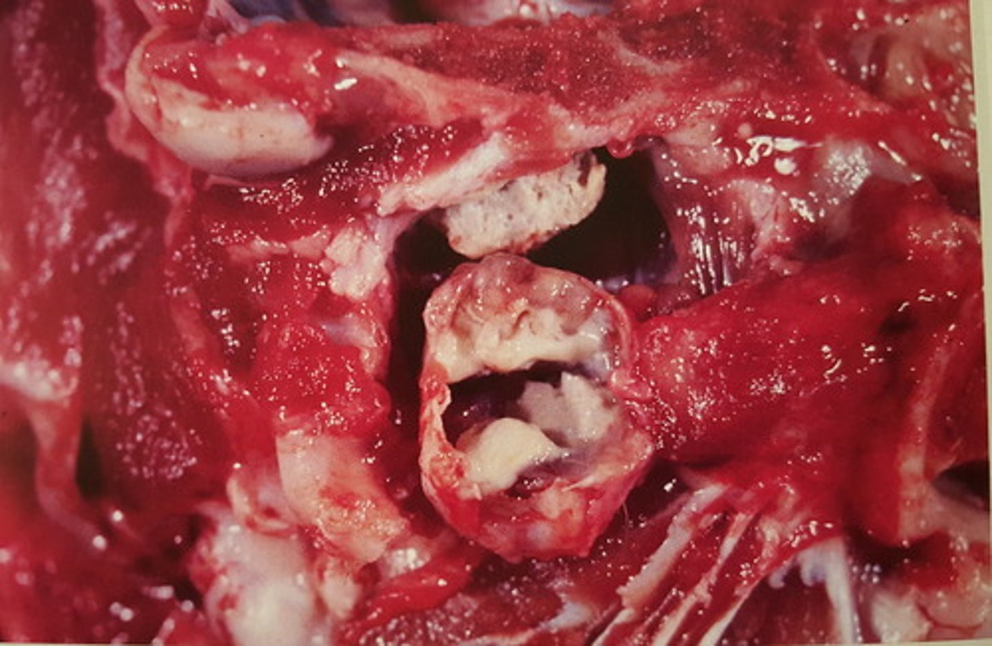 <p>Mellemøre fra svin. Patoanatomisk diagnose? Patogenese?</p>