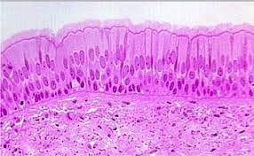 <p>a type of tissue found in the respiratory tract. It appears stratified due to the varying heights of its cells, but all cells are in contact with the basement membrane. The presence of cilia on the surface of the cells helps in moving mucus and trapped particles out of the respiratory system. This type of epithelium is important for protecting and maintaining the health of the respiratory tract.</p>