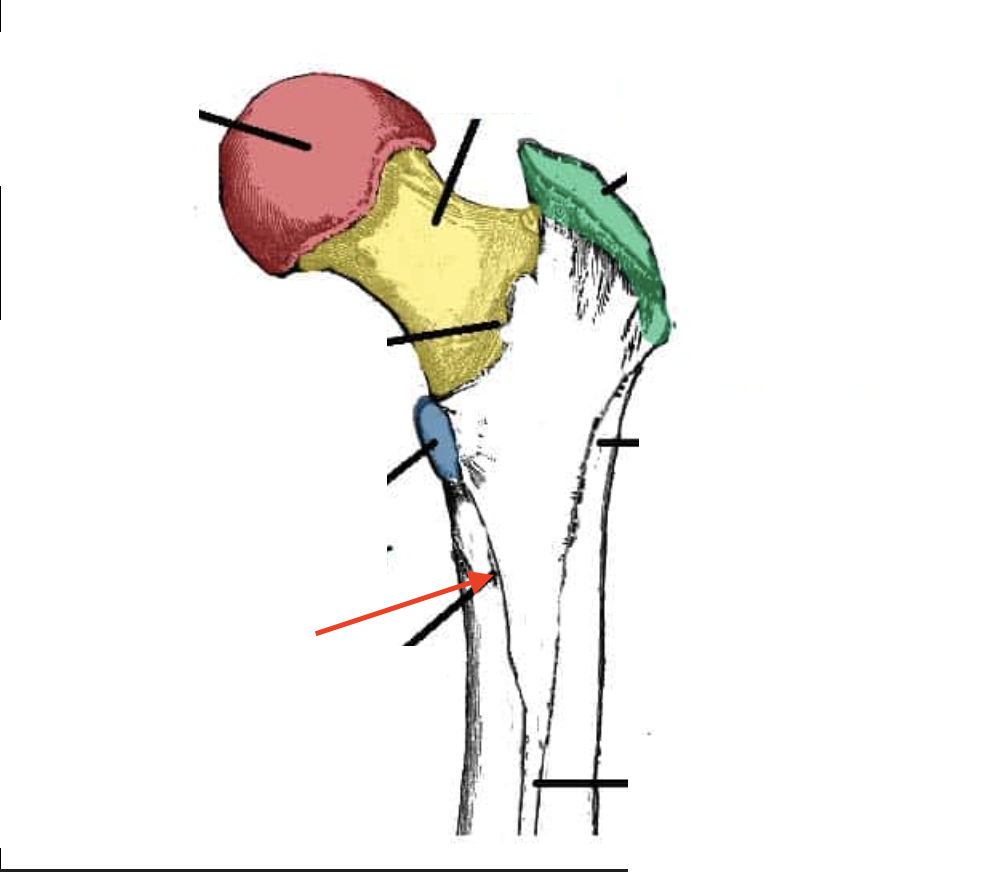 <p>the diagonal line out of the lesser trochanter, joins the linea aspera</p>