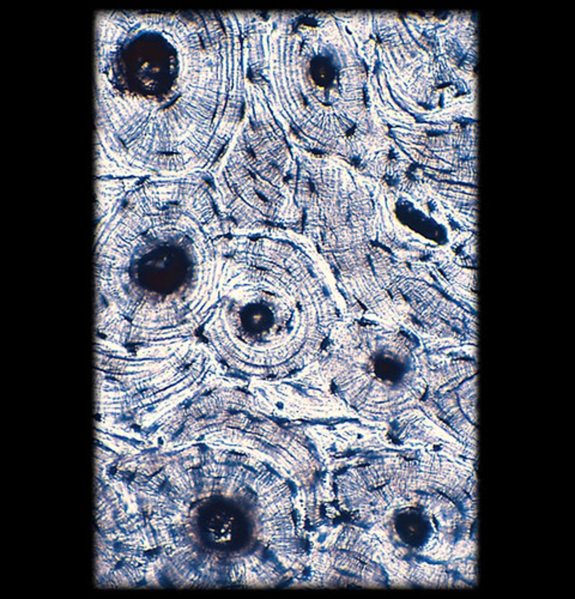 <p>- Dense, solid matrix with a layered (lamellar) structure.</p><p>- Osteons (cylindrical structures) are visible with a central canal surrounded by concentric lamellae.</p><p>- Appears as tree-ring-like circular structures (osteons) under the microscope with central canals and radiating lines (canaliculi).</p><p>- Found in the outer layer of bones.</p>