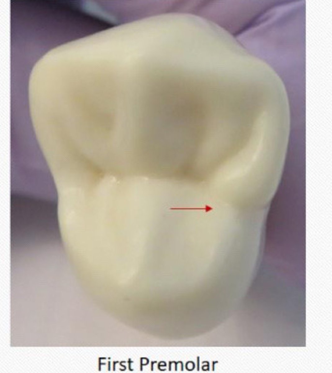 <p>On maxillary first premolar, the groove is Less frequently seen on __ groove.</p>