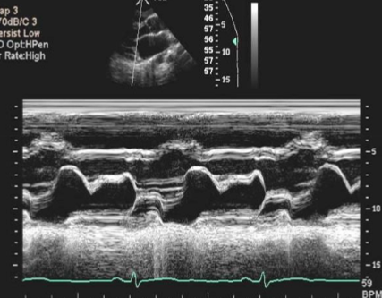 <p>Describe the rhythm of this patient.</p>