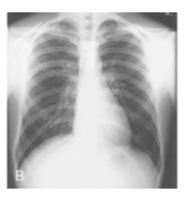 <p>Identify which body habitus this is</p>