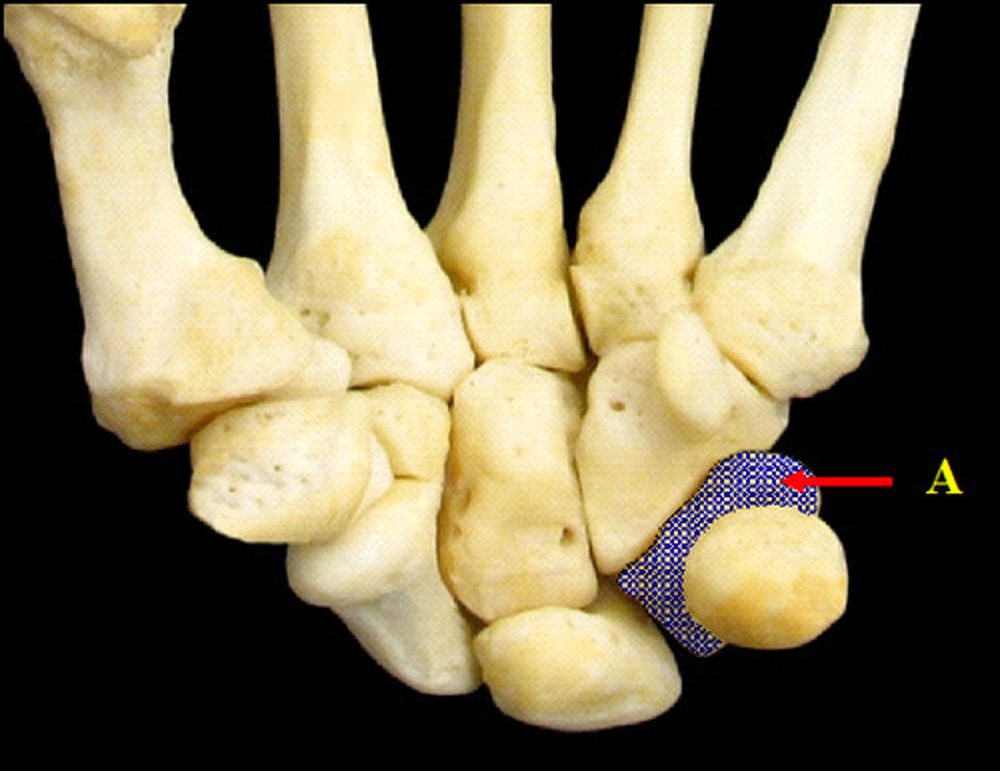 <p>Name this bone.</p>