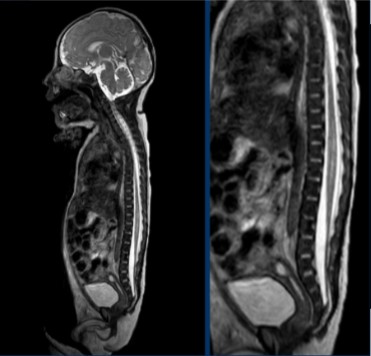<p>Which imaging modality was used for this scan?</p>