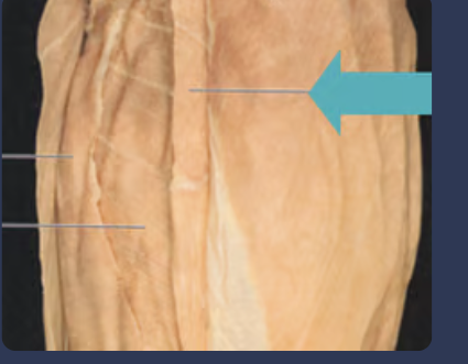<p>the middle line of the stomach</p>