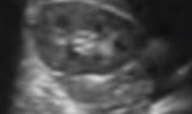 <p>What portion of the kidney is this that looks like a donut</p>