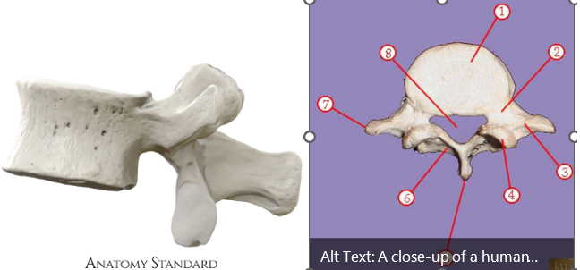<p><span>Name this type of vertebra&nbsp;</span></p>