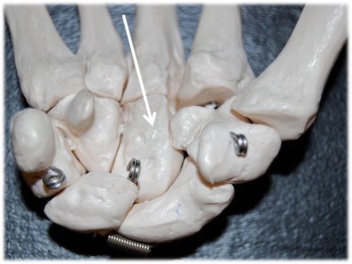 Name this carpal bone (anterior view).