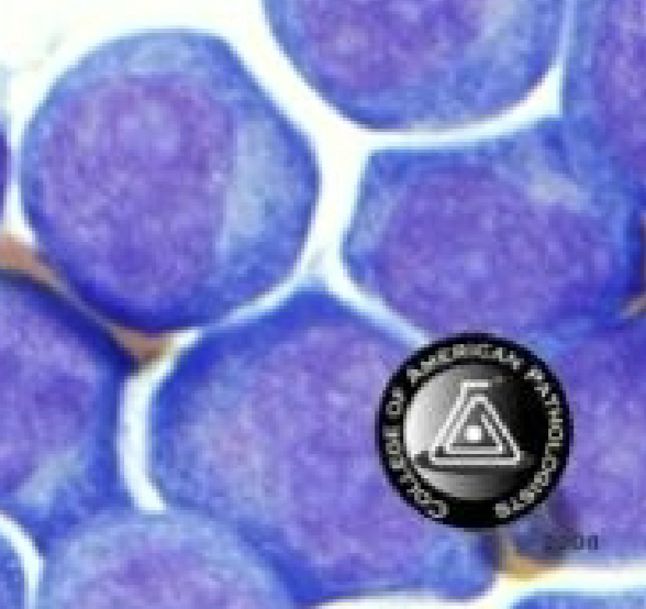<p>What are these cells and when would we see them?</p>
