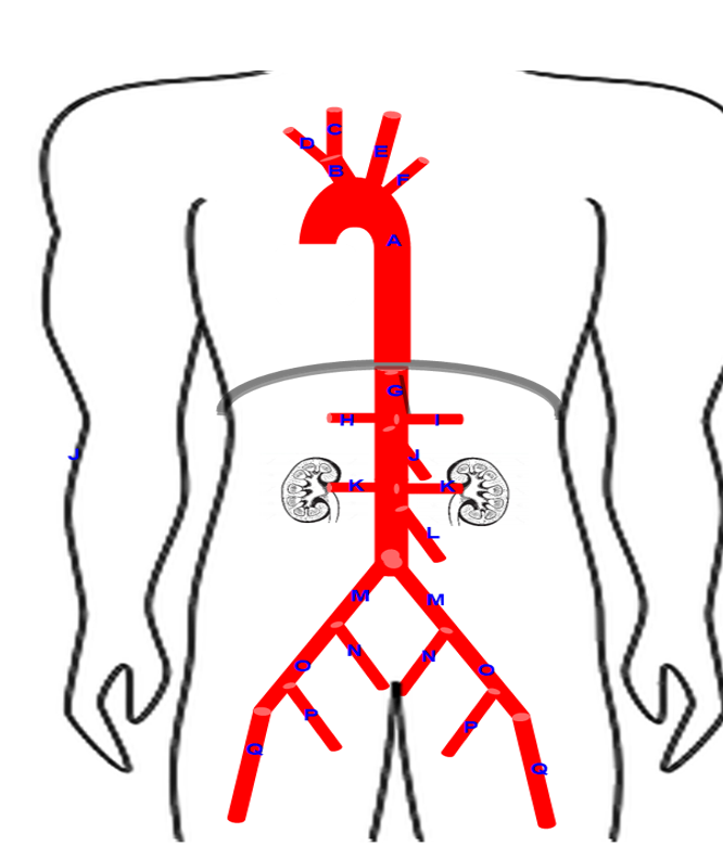 <p>Name the blood vessels</p>