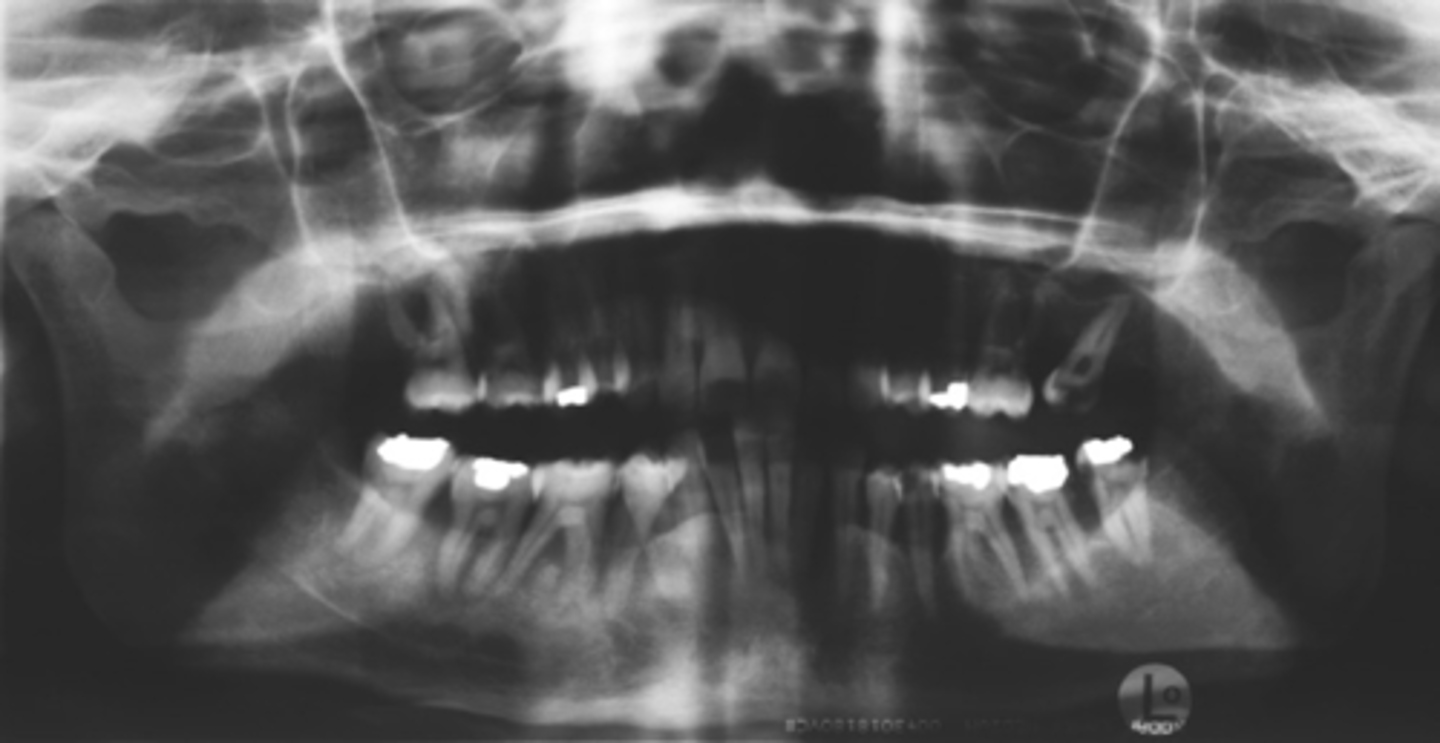 <p>ID the positional error from the radiograph:</p>