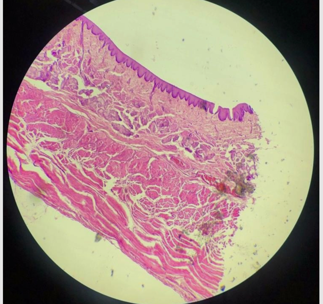 <p>Przełyk przekrój podłużny - <span>esophagus longitudinal section</span></p>