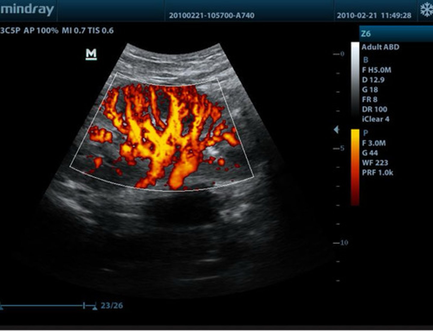 <p>what type of doppler is this?</p>