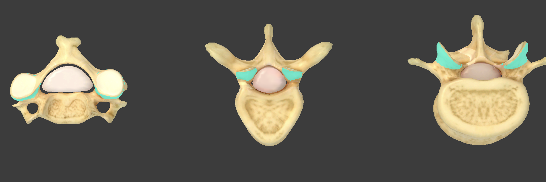 <p>what component of vertebrae is this?</p>