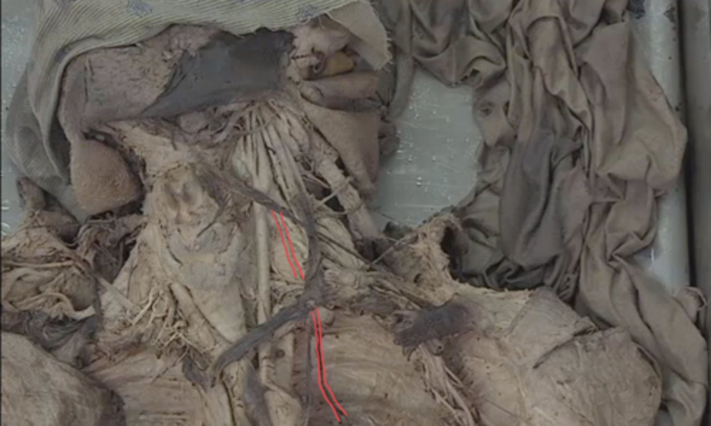 <p>identify this nerve</p>