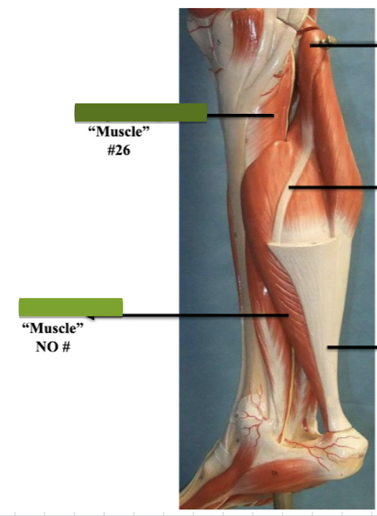 <p>Label muscle #26 </p>