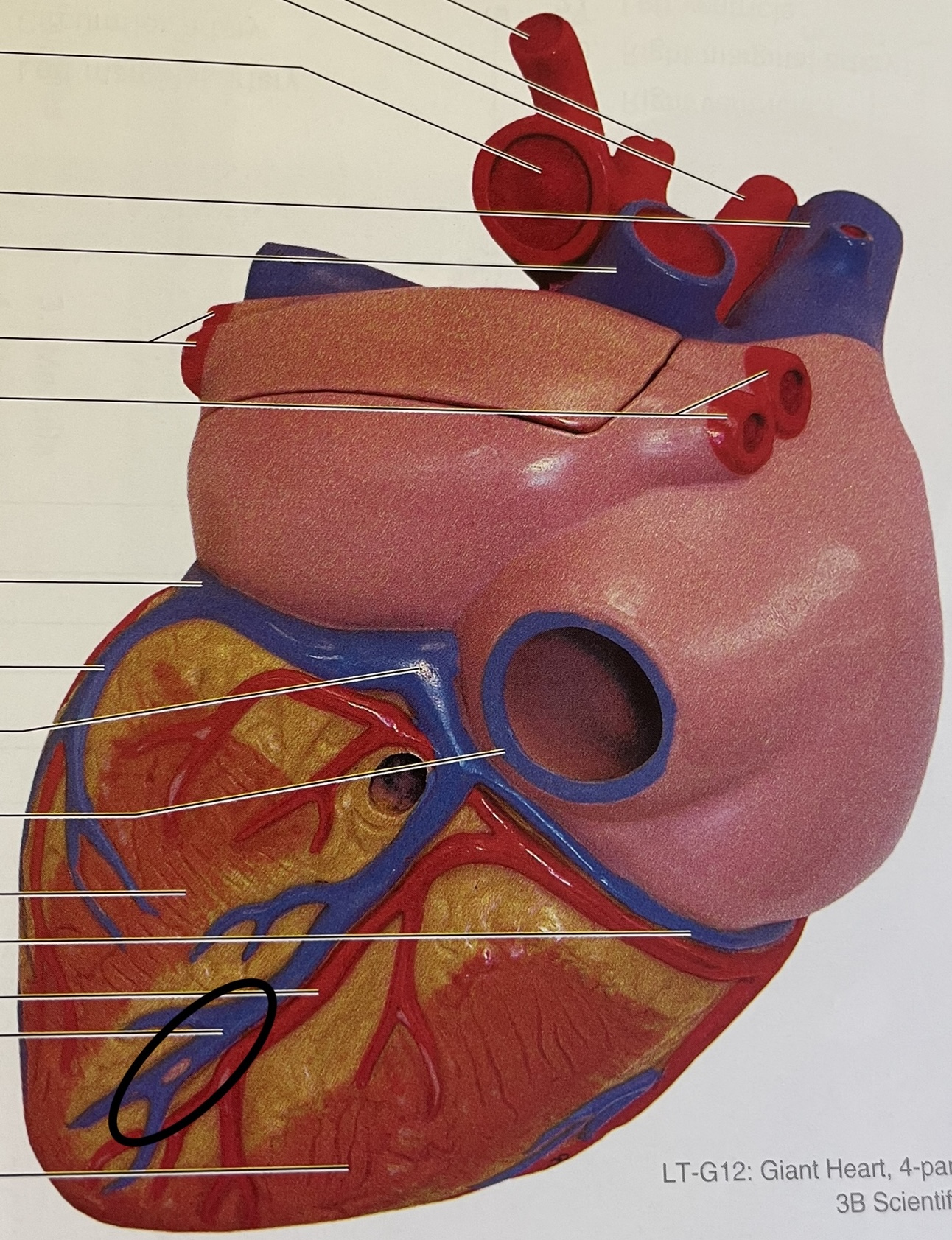 dump into coronary sinus on posterior
