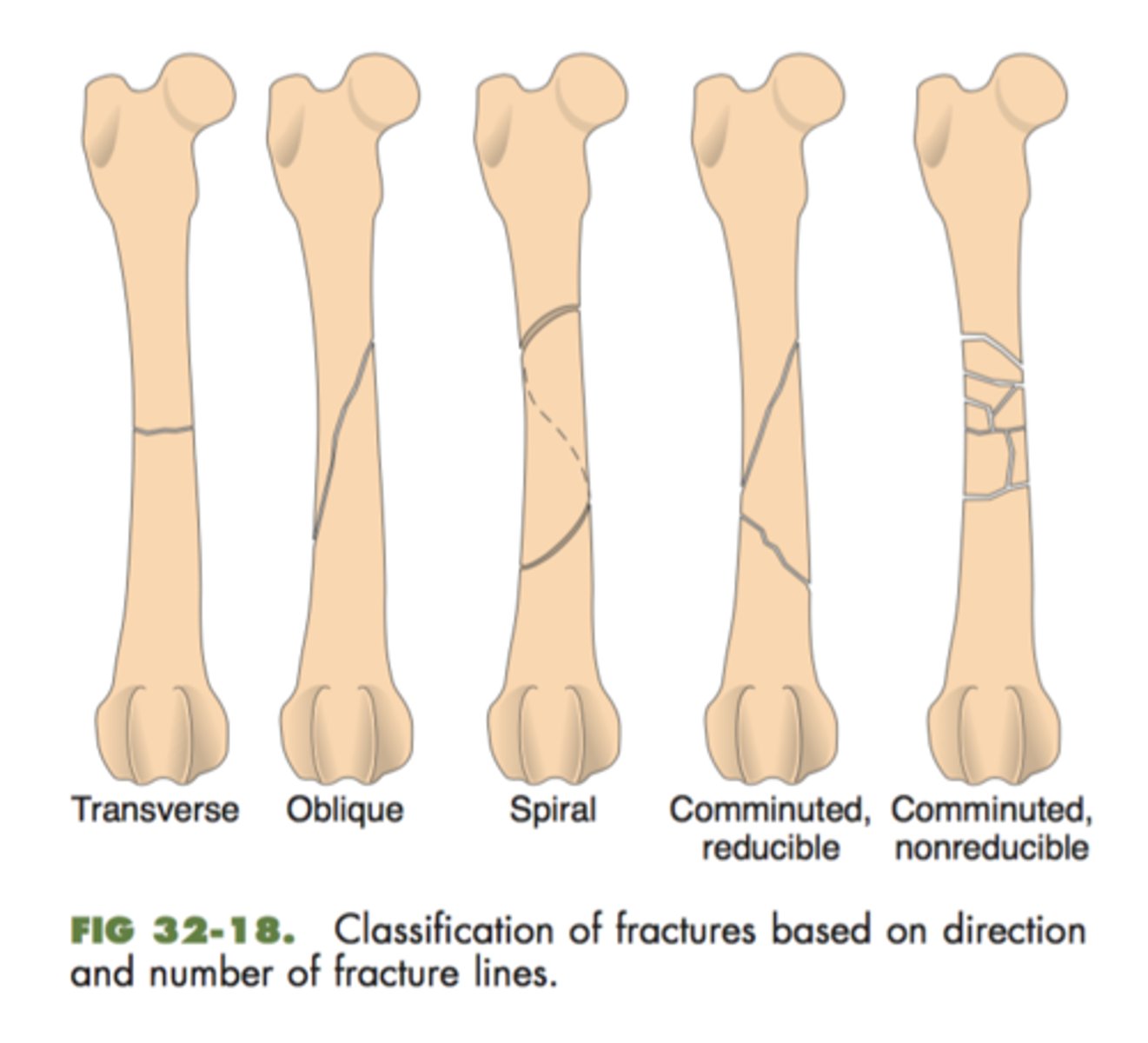 <p>direction of fracture</p>