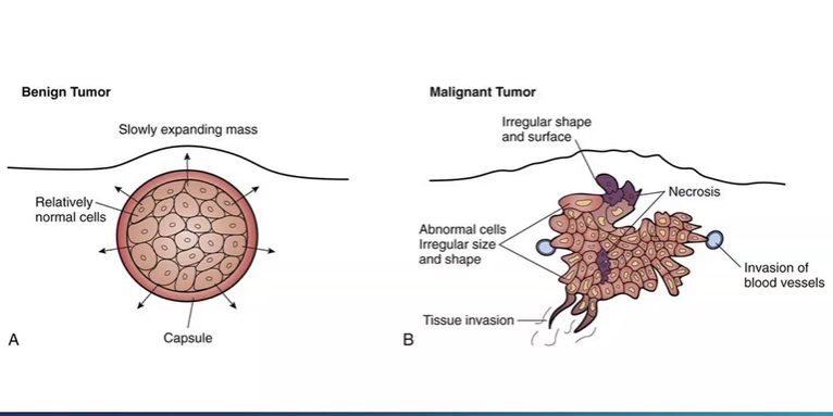 <ul><li><p>slow expanding mass , normal cells , proliferation than normal cells surrounding, often capsulated , smooth surface</p></li><li><p>more irregular shape, cells of different shapes and sizes, some cells die as not enough oxygen, some cells begin to invade nearby tissues</p></li></ul><p></p>