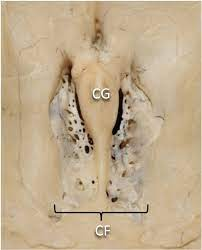 the flat part of the ethmoid bone in the skull floor
