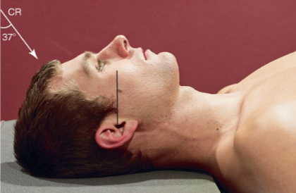 <p>Identify patient’s position &amp; projection</p>