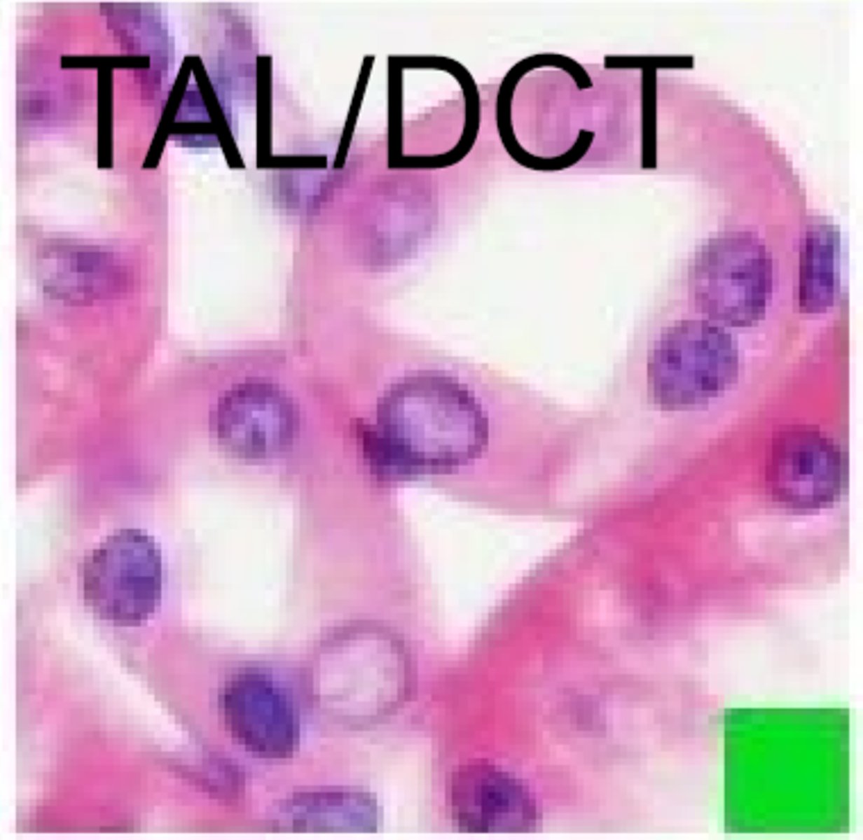 <p>more cuboidal, no brush border</p>