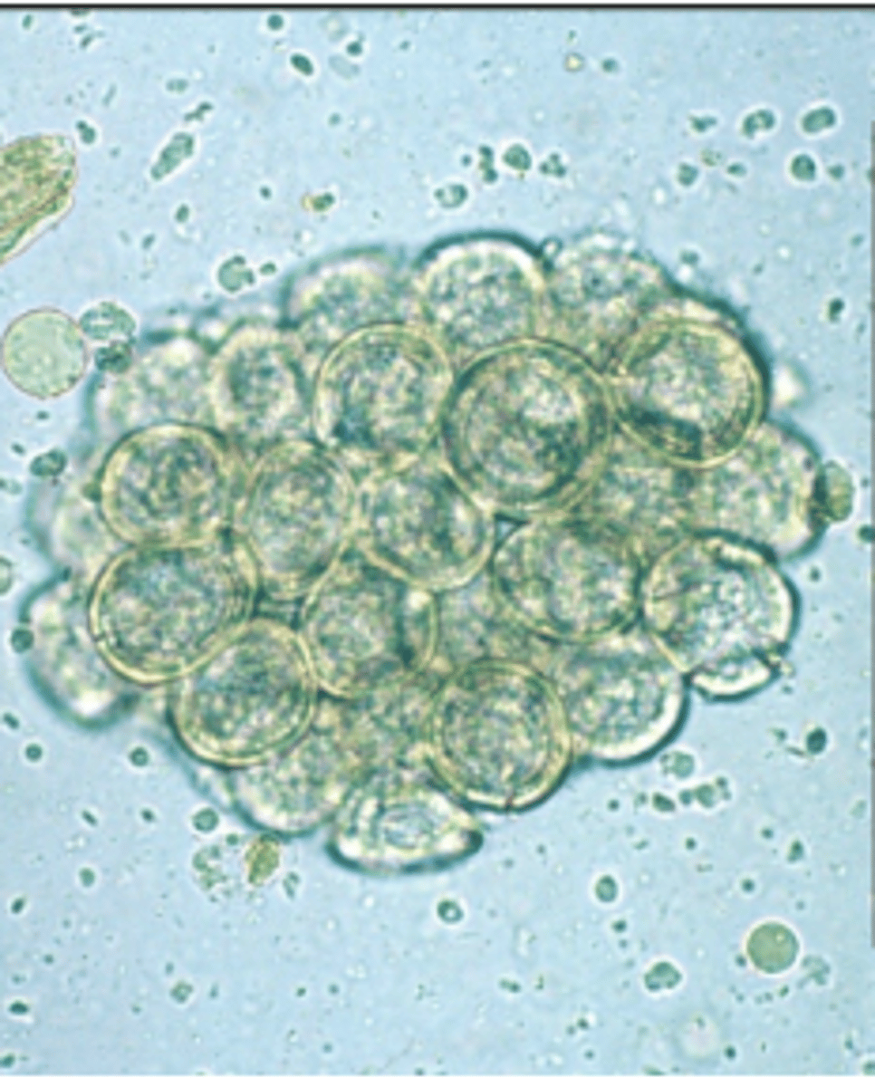 <p>These eggs were found in the fecal sample of a 10 year old Yorkshire Terrier. The dog had been treated for the same worms once before, why did the treatment not work?</p>