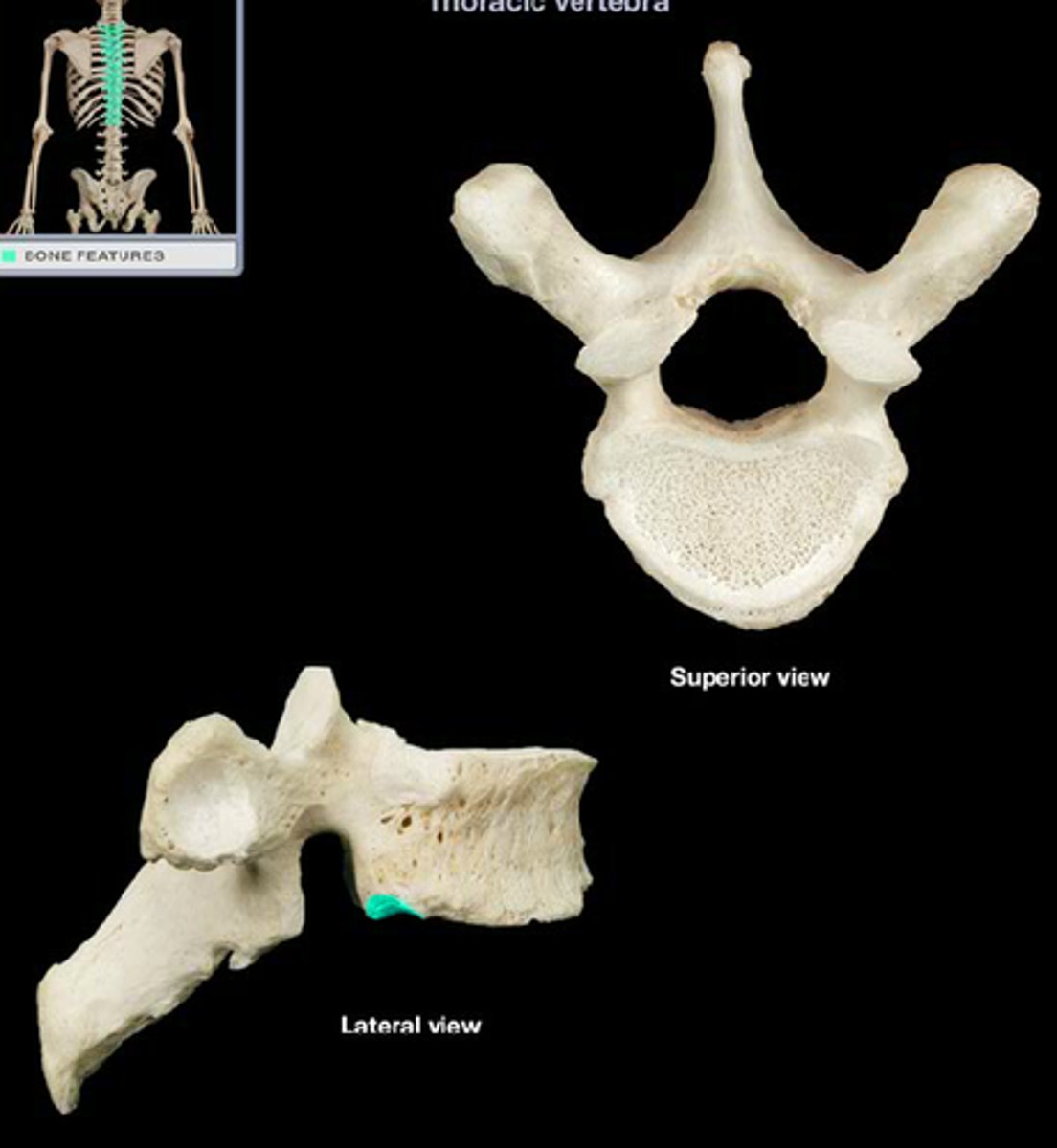 <p>Present on T1-T8, where the inferior articular facet of the ribs sit connecting to the facet of the superior. Absent on T9-T12</p>
