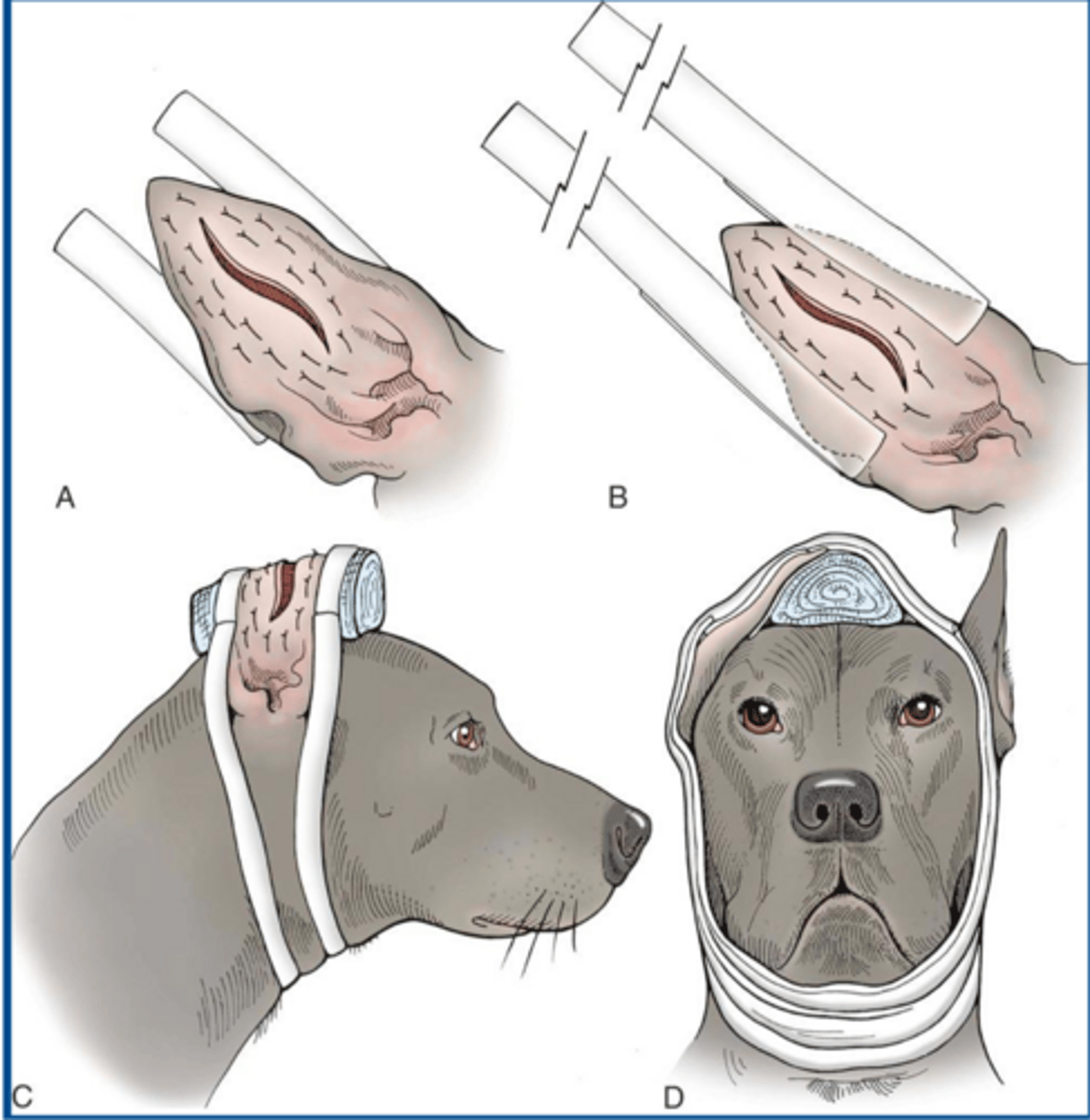 <p>what procedure is shown here</p>