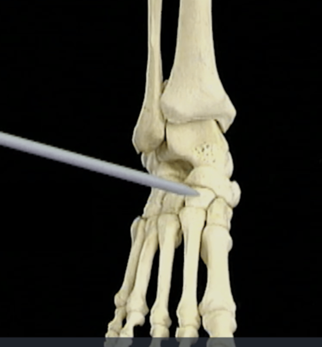 <p>What bone is this?</p>