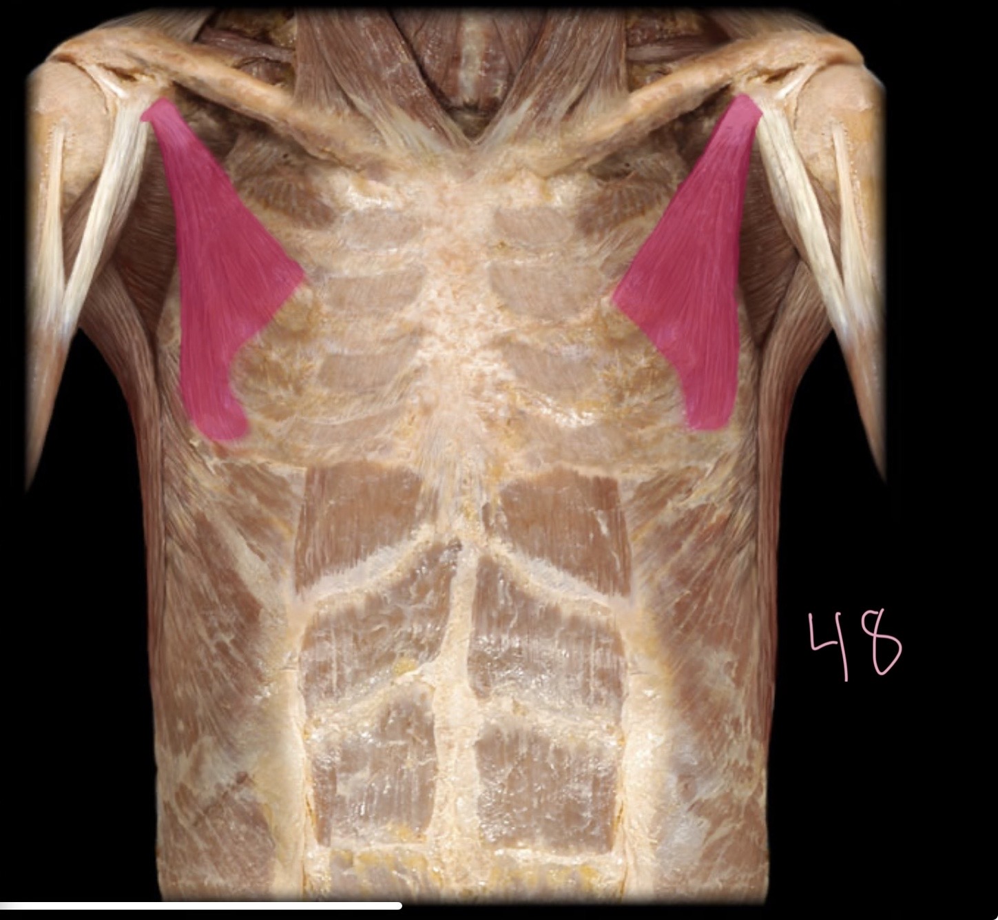 <p>Pectoralis minor</p>