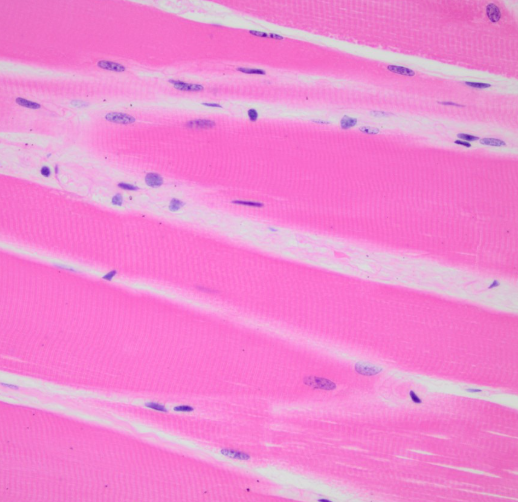 <p>Is skeletal muscle voluntary or involuntary?</p>