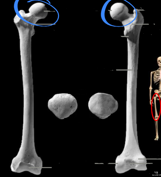 <p>Located on the femur, articulated with the acetabulum located in the pelvis</p>