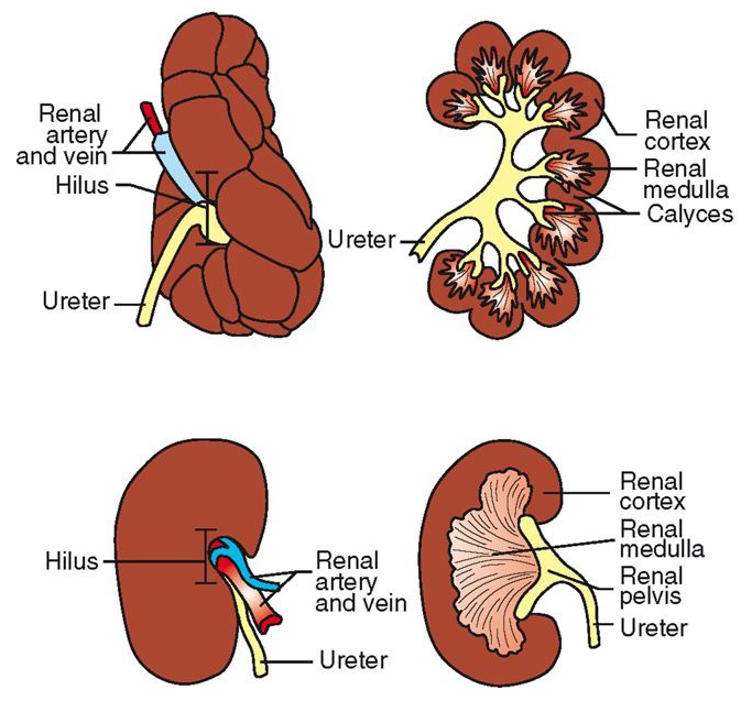 <ol><li><p>Multilobar</p></li><li><p>Unilobar</p></li></ol><p></p>