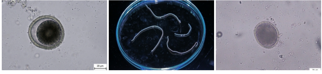 <p><strong>toxocara canis</strong></p><p>M, subspherical, 3 thick shells, unembryonated - 1 blastomere, dark brown color. </p><p>SI, nematode. </p>