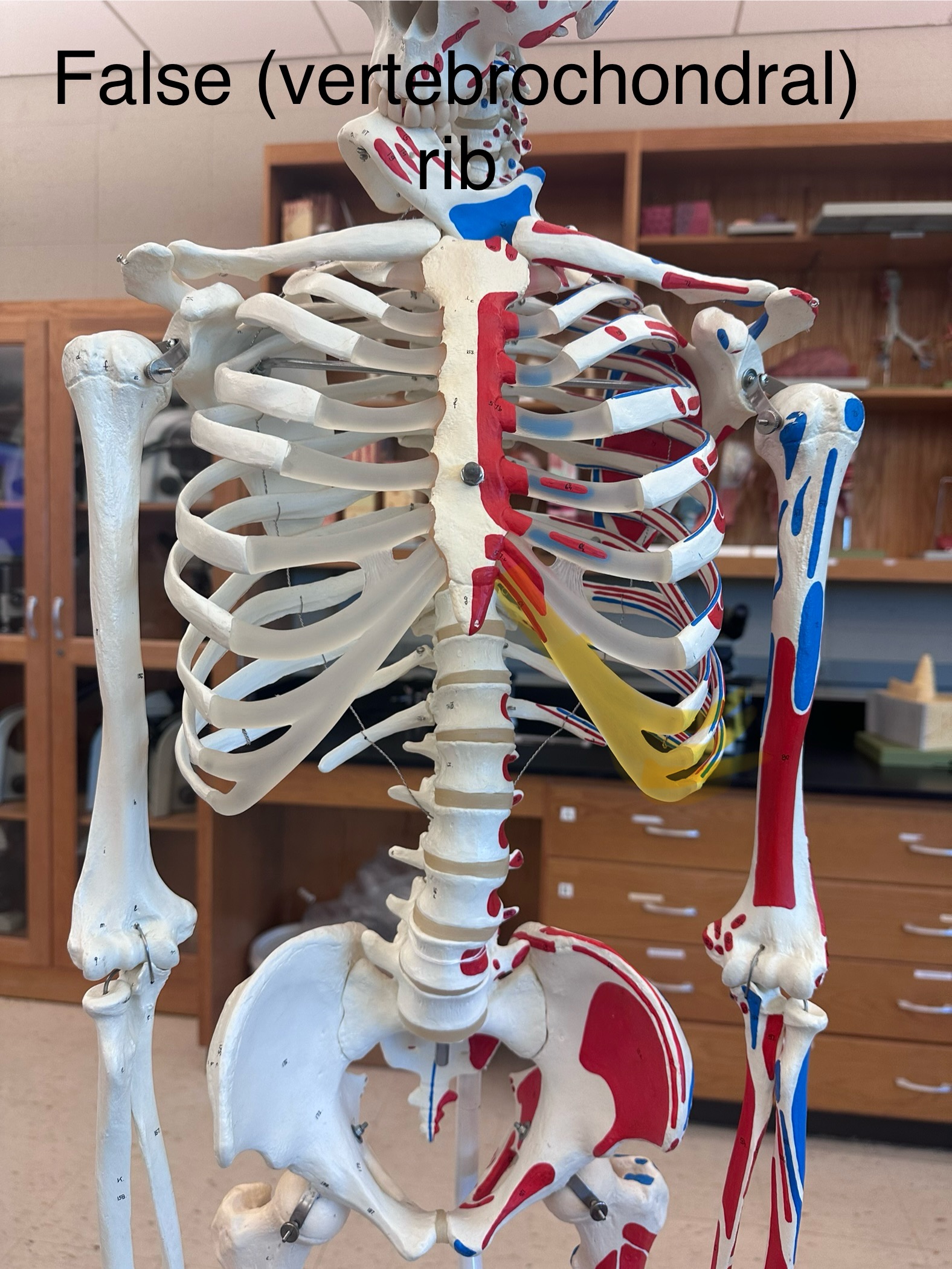 <p>Vertebrochondral ribs (false)</p>